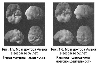 Измени мозг - изменится и тело - _6.jpg