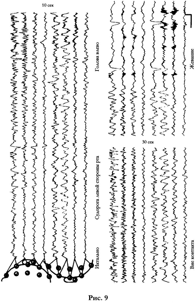 Сон, сновидения и смерть. Исследование структуры сознания. - pic10t255.png